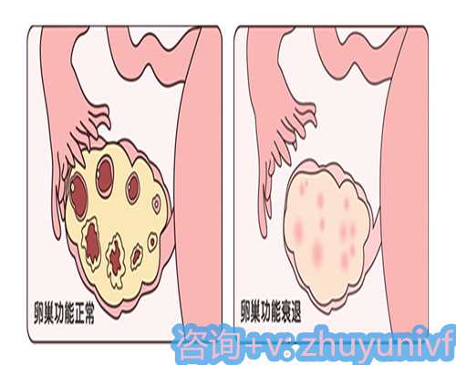 重庆代孕医疗公司,重庆妇幼可以做供精试管吗？附详细试管流程