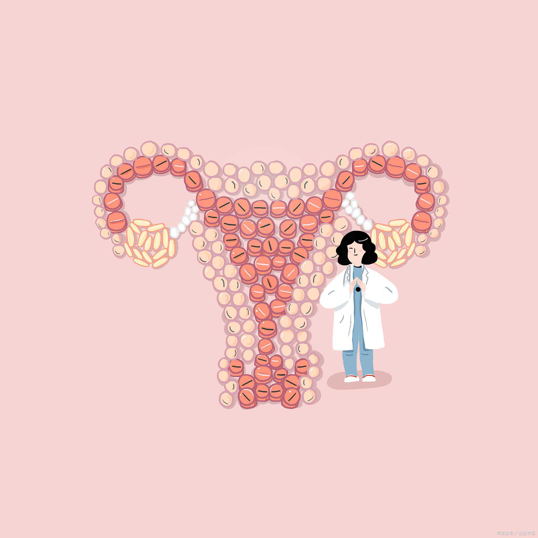 多囊卵巢综合征患者不备孕需要治疗吗？可以治好吗？